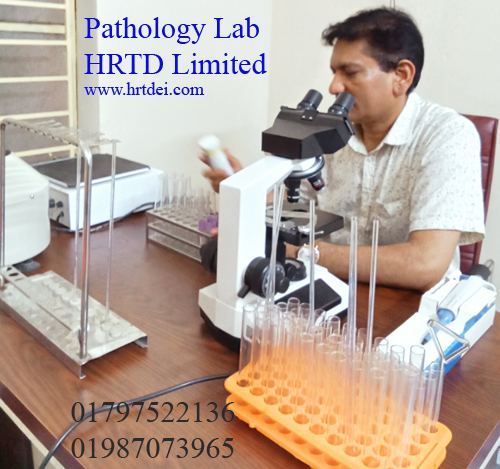 HBsAg Test Lab in Mirpur