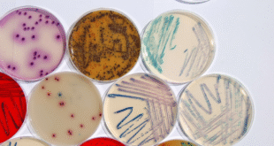Urine Culture and Sensitivity Test
