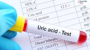 Uric Acid Test