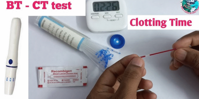 BT/CT Test