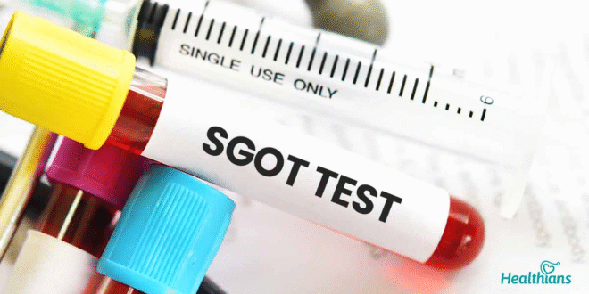 SGOT (AST) Test