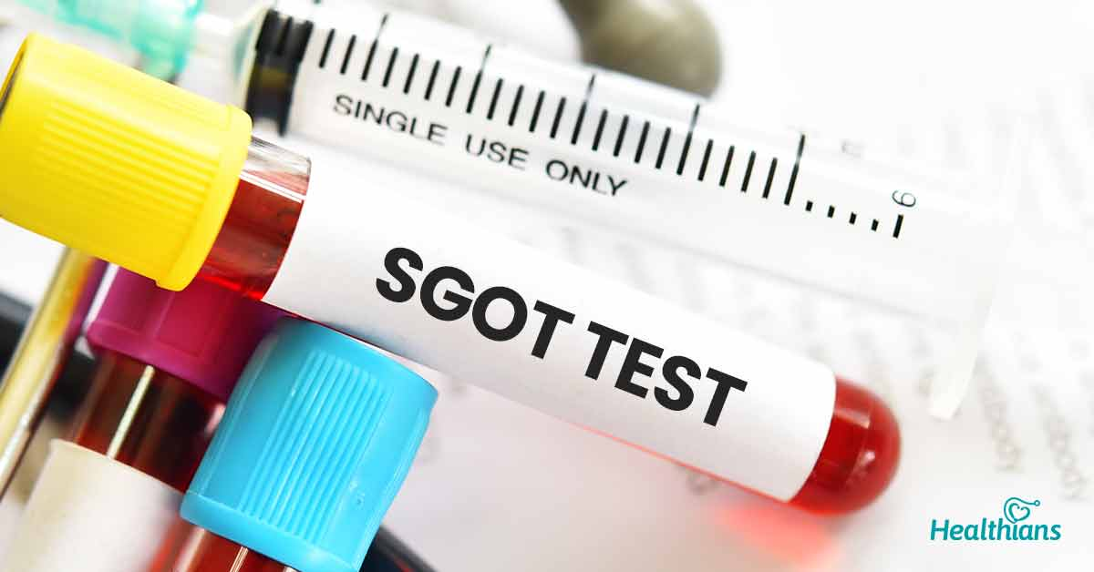 Best Ast best SGOT (AST) Test 01797522136