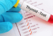 Thyroid Function Test Training