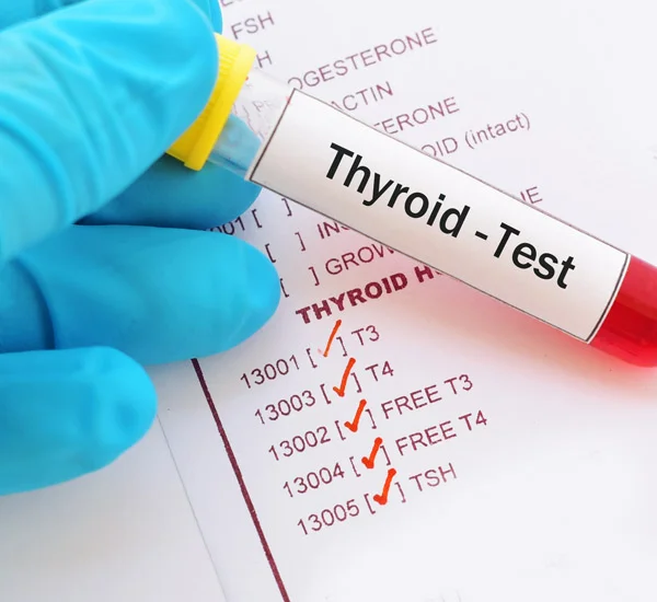 Free Thyroxine Test (FT4 Test) 5 Thyroid Function Test Training