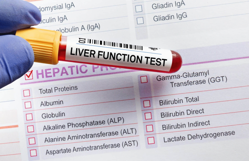 Liver Function Test Training Center: HRTD Medical Institute 2 Liver Function Test