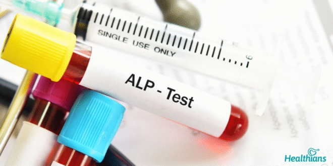 Alkaline Phosphatase Test