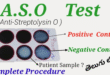 ASO Test