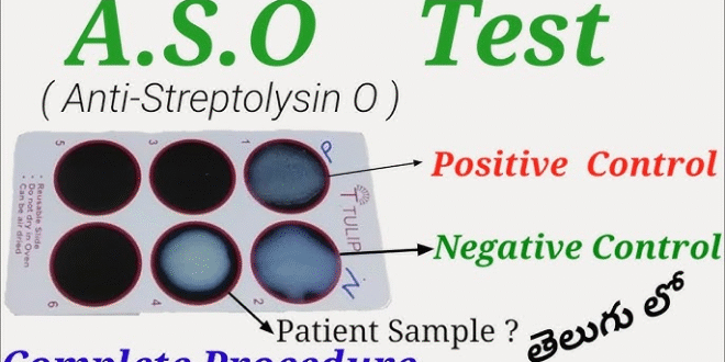 ASO Test