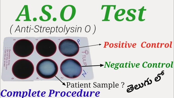 ASO Test 2 image 1