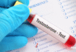 Testosterone Test
