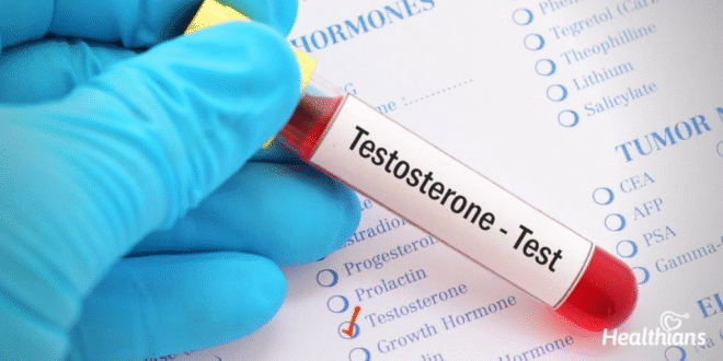 Testosterone Test