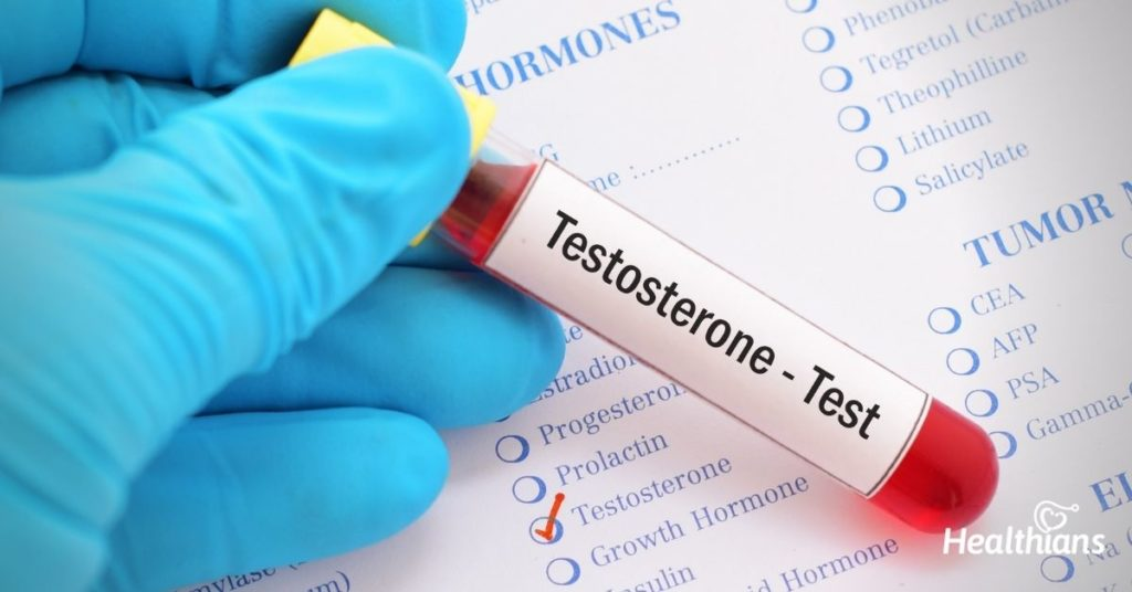 Testosterone Test 2 image 2