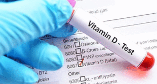 Vitamin D Test