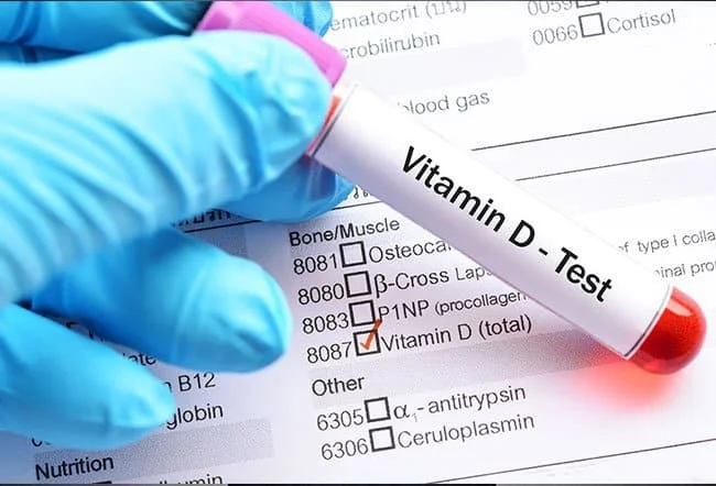 Vitamin D Test 2 image 6