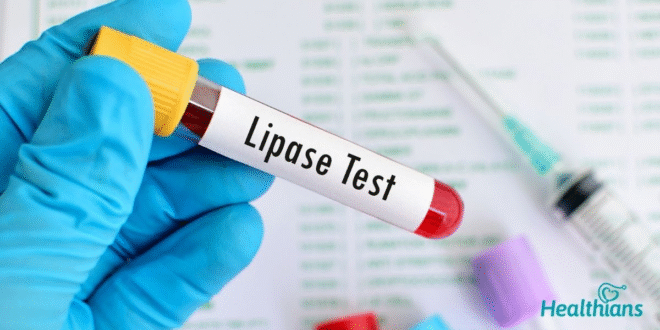 Serum Lipase Test