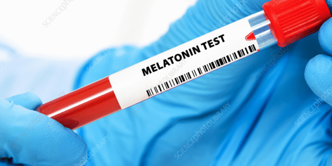 Melatonin Test