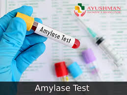 Amylase Test 2 image