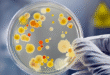 Pus Culture and Sensitivity Test