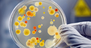 Pus Culture and Sensitivity Test