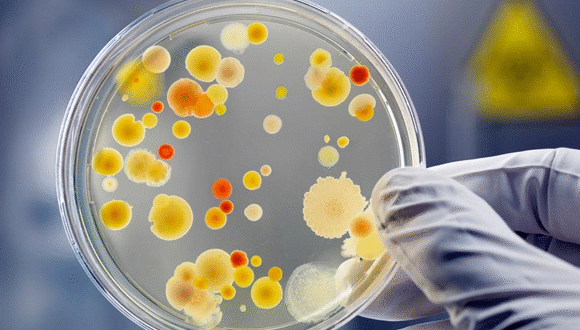 Pus Culture and Sensitivity Test