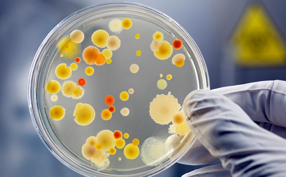 Pus Culture and Sensitivity Test 2 image 2