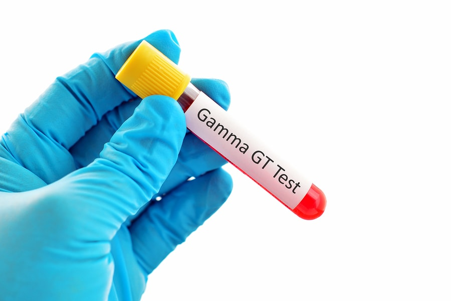 Gamma Glutamyl Transferase Test 1 image 4