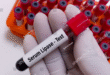 Serum Lipase Test