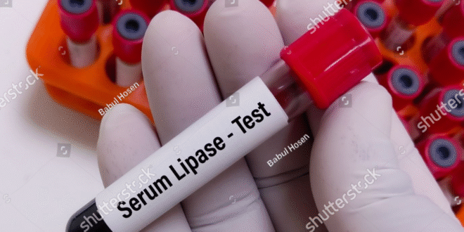 Serum Lipase Test