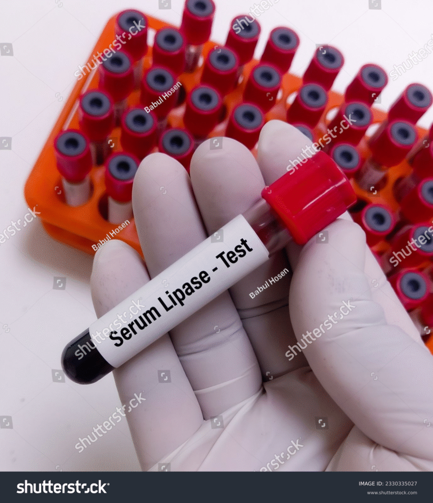 Serum Lipase Test 2 image 3